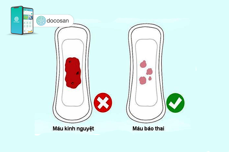 Máu báo thai - Hiểu đúng bản chất của hiện tượng này
