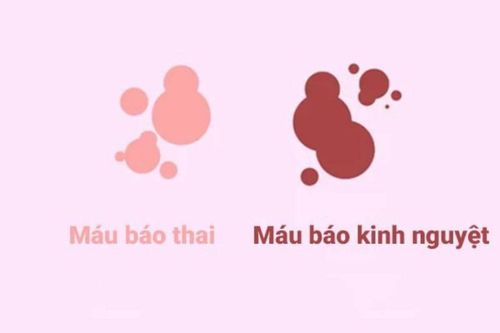 Máu báo thai - Nên làm gì ngay khi vừa phát hiện ra máu